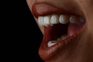 سعر ابتسامة هوليود في مصر